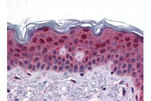 Human Skin: Formalin-Fixed, Paraffin-Embedded (FFPE) (FAM120B 抗体  (C-Term))