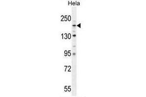 Western Blotting (WB) image for anti-Collagen, Type IV, alpha 2 (COL4A2) (AA 163-194), (Chain alpha 2), (N-Term) antibody (ABIN951623)