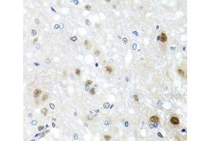 Immunohistochemistry of paraffin-embedded Rat brain using SAFB2 Polyclonal Antibody at dilution of 1:100 (40x lens). (SAFB2 抗体)