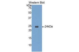 Western Blotting (WB) image for anti-Insulin-Like Growth Factor Binding Protein 6 (IGFBP6) (AA 51-226) antibody (ABIN1859311) (IGFBP6 抗体  (AA 51-226))