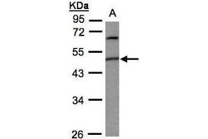 WB Image Sample(30 ug whole cell lysate) A:293T 10% SDS PAGE antibody diluted at 1:1000 (PIGK 抗体)