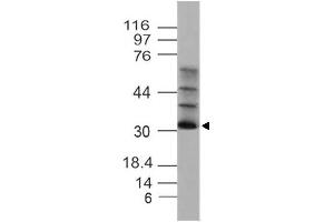 Image no. 1 for anti-Solute Carrier Family 25, Member 27 (SLC25A27) (AA 150-320) antibody (ABIN5027621)