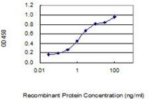 Detection limit for recombinant GST tagged SCML4 is 0. (SCML4 抗体  (AA 1-305))