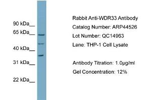 WB Suggested Anti-WDR33  Antibody Titration: 0. (WDR33 抗体  (N-Term))