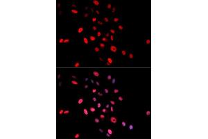 Immunofluorescence analysis of MCF-7 cells using Phospho-Jun-S63 antibody (ABIN5969905). (C-JUN 抗体  (pSer63))
