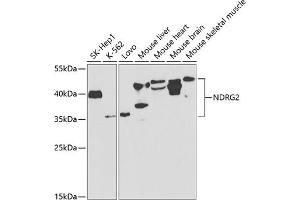 Western blot analysis of extracts of various cell lines, using NDRG2 antibody (ABIN6128325, ABIN6144451, ABIN6144452 and ABIN6220946) at 1:1000 dilution. (NDRG2 抗体  (AA 138-357))