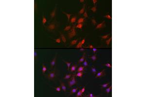 Immunohistochemistry of paraffin-embedded mouse lung using GAPDH Rabbit pAb (ABIN3020537, ABIN3020538 and ABIN3020539) at dilution of 1:100 (40x lens). (GAPDH 抗体  (AA 1-335))