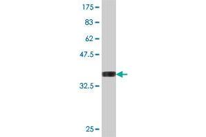 Western Blot detection against Immunogen (37. (CMPK2 抗体  (AA 151-250))