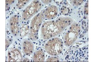 Image no. 1 for anti-Cancer/testis Antigen 1B (CTAG1B) antibody (ABIN1499890) (CTAG1B 抗体)