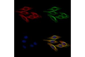 ABIN6265518 and ABIN6278536 staining HepG2 cells by IF/ICC.