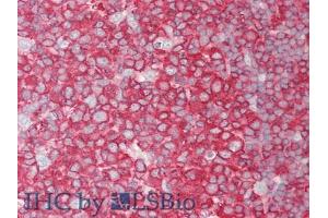 IHC-P analysis of Human Tonsil Tissue, with HE staining. (PCSK9 抗体  (AA 454-679))