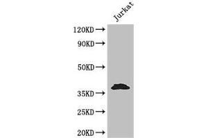 Western Blot Positive WB detected in: Jurkat whole cell lysate All lanes: MCL1 antibody at 3. (MCL-1 抗体  (AA 19-244))