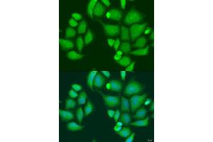 Immunofluorescence analysis of U2OS cells using CAPN2 antibody. (Calpain 2 抗体  (AA 350-680))