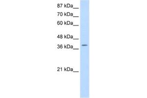 Western Blotting (WB) image for anti-K(lysine) Acetyltransferase 6B (KAT6B) antibody (ABIN2461835)