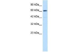Human Jurkat; WB Suggested Anti-ZNF499 Antibody Titration: 0. (ZBTB45 抗体  (Middle Region))