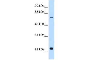WB Suggested Anti-SLC17A5 Antibody Titration:  0. (Solute Carrier Family 17 (Acidic Sugar Transporter), Member 5 (SLC17A5) (N-Term) 抗体)