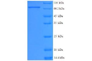 SDS-PAGE (SDS) image for Eyes Absent Homolog 2 (Drosophila) (EYA2) (AA 1-514), (Isoform 2) protein (His-SUMO Tag) (ABIN5709489)