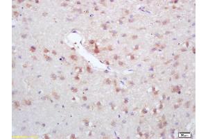 Formalin-fixed and paraffin embedded rat brain labeled with Rabbit Anti GAD67/GAD1 Polyclonal Antibody, Unconjugated (ABIN674679) at 1:200 followed by conjugation to the secondary antibody and DAB staining