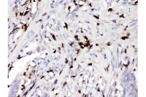 Immunohistochemistry (IHC) image for anti-Orosomucoid 1 (ORM1) (AA 19-201) antibody (ABIN4886686)
