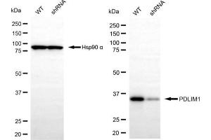 Western blotting analysis using PDLIM1 antibody (ABIN7799747).