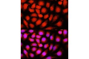 Immunofluorescence analysis of HeLa cells using ACADVL antibody  at dilution of 1:100 (40x lens). (ACADVL 抗体  (AA 1-140))