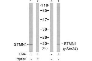 Image no. 2 for anti-Stathmin 1 (STMN1) (pSer24) antibody (ABIN196968) (Stathmin 1 抗体  (pSer24))