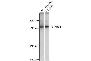 Western blot analysis of extracts of various cell lines, using ST antibody (ABIN7270584) at 1000 dilution. (STARD4 抗体  (AA 1-100))