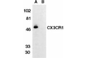 Image no. 1 for anti-Chemokine (C-X3-C Motif) Receptor 1 (CX3CR1) (AA 175-189) antibody (ABIN319015) (CX3CR1 抗体  (AA 175-189))