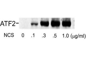 Western blot of human melanoma cells incubated with varying doses of the radiomimetic drug NCS showing specific immuno-labeling of the ~74k ATF2 protein phosphorylated at Ser490 and Ser498. (ATF2 抗体  (pSer490, pSer498))