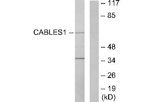 Western blot analysis of extracts from LOVO cells, using Ik3-1 antibody. (CABLES1 抗体)