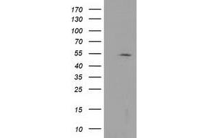 Western Blotting (WB) image for anti-Histone Deacetylase 1 (HDAC1) antibody (ABIN1498605) (HDAC1 抗体)