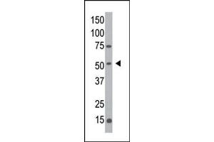Image no. 1 for anti-Mannosyl (Alpha-1,3-)-Glycoprotein beta-1,2-N-Acetylglucosaminyltransferase (MGAT1) (C-Term) antibody (ABIN357695) (MGAT1 抗体  (C-Term))