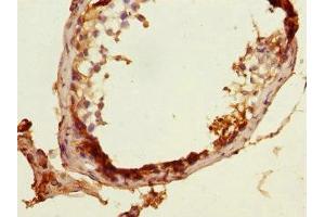 Immunohistochemistry of paraffin-embedded human testis tissue using ABIN7160476 at dilution of 1:100 (MLF1 抗体  (AA 1-268))