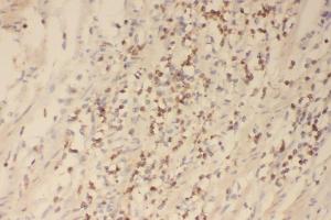 IHC analysis of Profilin 1 using anti-Profilin 1 antibody (ABIN3043603).