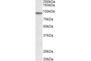 Western Blotting (WB) image for anti-Patched Domain Containing 3 (PTCHD3) (Internal Region) antibody (ABIN2465068) (PTCHD3 抗体  (Internal Region))