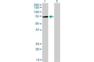 Western Blot analysis of PIAS3 expression in transfected 293T cell line by PIAS3 monoclonal antibody (M03), clone 4F12. (PIAS3 抗体  (AA 453-550))