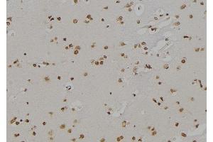 ABIN6259891 and ABIN6277140 at 1/100 staining Human brain tissue by IHC-P.