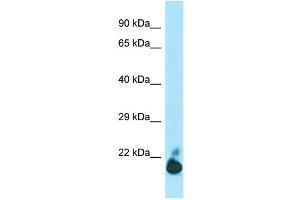 WB Suggested Anti-TIGIT Antibody Titration: 1. (TIGIT 抗体  (C-Term))
