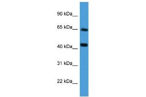 Western Blotting (WB) image for anti-Collagen, Type VIII, alpha 2 (COL8A2) (Middle Region) antibody (ABIN2788308) (COL8a2 抗体  (Middle Region))