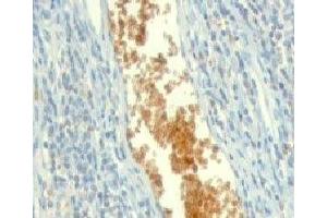 Formalin-fixed, paraffin-embedded human tonsil stained with AMPD3 antibody (clone ETAD3-1). (AMPD3 抗体)