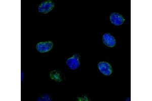 Immunofluorescence (IF) image for anti-Nucleoporin 214kDa (NUP214) (AA 1250-1300) antibody (ABIN7448921)