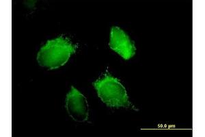 Immunofluorescence of purified MaxPab antibody to HNRPD on HeLa cell. (HNRNPD/AUF1 抗体  (AA 1-355))