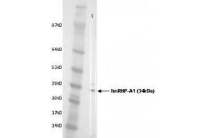 Image no. 2 for anti-Heterogeneous Nuclear Ribonucleoprotein A1 (HNRNPA1) antibody (ABIN108610)