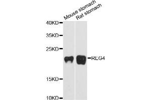 Western blot analysis of extracts of various cell lines, using REG4 antibody (ABIN6293540) at 1:3000 dilution.
