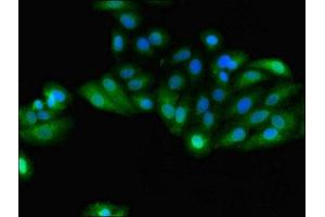 Immunofluorescent analysis of HepG2 cells using ABIN7154093 at dilution of 1:100 and Alexa Fluor 488-congugated AffiniPure Goat Anti-Rabbit IgG(H+L) (GSTA4 抗体  (AA 1-222))