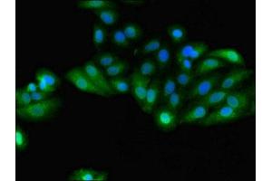 Immunofluorescent analysis of HepG2 cells using ABIN7154093 at dilution of 1:100 and Alexa Fluor 488-congugated AffiniPure Goat Anti-Rabbit IgG(H+L) (GSTA4 抗体  (AA 1-222))