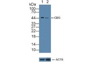 Western Blotting (WB) image for anti-serpin Peptidase Inhibitor, Clade A (Alpha-1 Antiproteinase, Antitrypsin), Member 6 (SERPINA6) antibody (ABIN7646024)