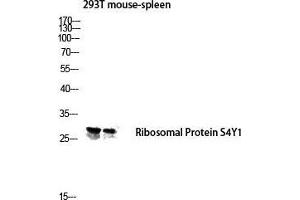 Western Blot (WB) analysis of 293T Mouse Spleen lysis using Ribosomal Protein S4Y1 antibody. (Ribosomal Protein S4Y1 (C-Term) 抗体)