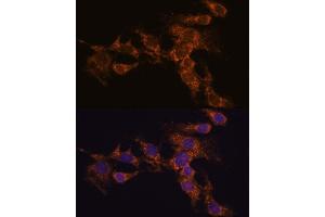 Immunofluorescence analysis of C6 cells using PYCR2 antibody (ABIN7269766) at dilution of 1:100. (PYCR2 抗体  (AA 271-320))