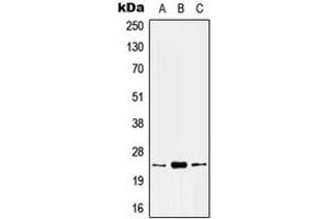 Western blot analysis of Kallikrein 8 expression in HEK293T (A), mouse kidney (B), rat kidney (C) whole cell lysates. (Kallikrein 8 抗体  (N-Term))